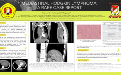 Mediastinal Hodgkin Lymphoma: A Rare Case Report