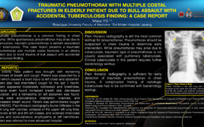 Traumatic Pneumothorax with Multiple Costal Fractures in Elderly Patient Due to Bull Assault with Accidental Tuberculosis Finding: A Case Report